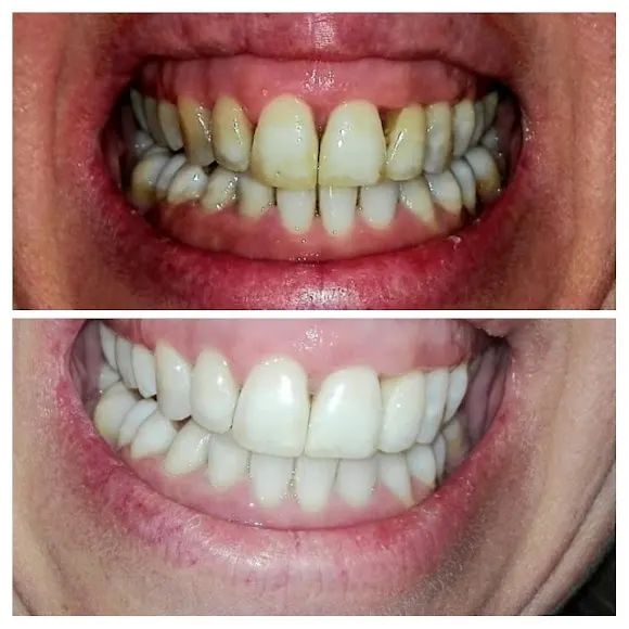 Dental y Podologia Luna Nueva | Dentista en Rivas Vaciamadrid | Implantes en Rivas